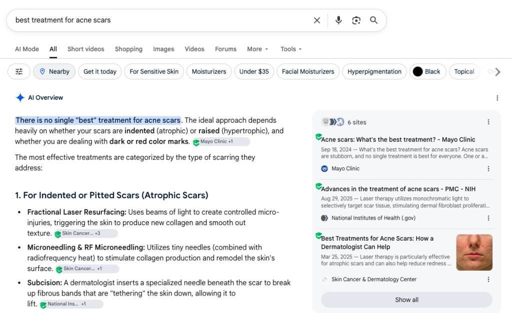 Screenshot of a web search for 'best treatment for acne scars' showing results and a side panel with related articles about acne scar treatments.